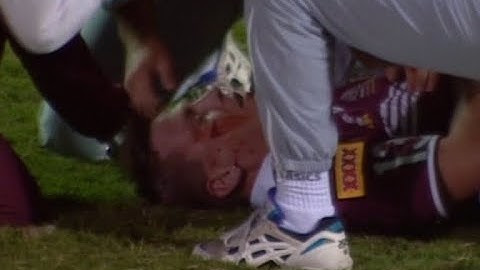 Ian Roberts Breaks Jason Smith's Jaw - Origin 1994