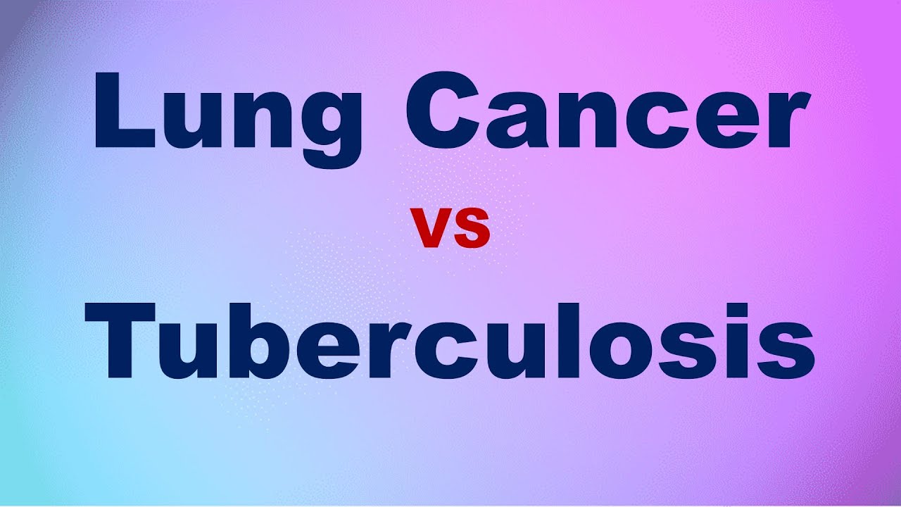 Lung Cancer VS TB YouTube lung-cancer-vs-tb-youtube