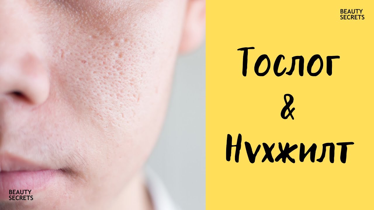 Арьс арчилгааны анхан шатны хичээл #4: Тослогжилт ба нүхжилт