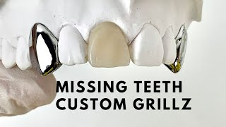 Missing Teeth Custom Grillz