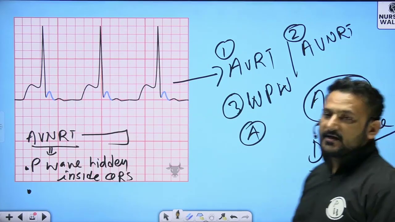 25 Cardiovascular System 25   Dysarrhythmia Part 3    Rescheduled