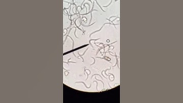 C. elegans dpy-11 Mutants (10x)