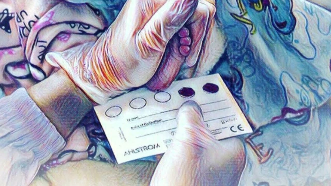 Зачем они это делают "Ахиллесова пята"? - YouTube