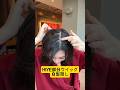 安心の部分ウイング　人毛100%レミーヘアー・総手植え・超リアリシルクスキン　ヘアーピース　白髮隠し　薄毛隠し　ボリュームアップ　いろんな髪の毛のお悩みを解決