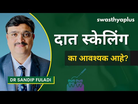 दातांचे स्केलिंग: आपण किती नियमितपणे दात मोजावे? | Scaling of Teeth in Marathi | Dr Sandip Fuladi