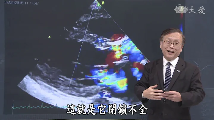 【大爱医生馆】20190523 - 心脏减肥 - 天天要闻