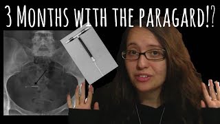 Paragard IUD 3 Month Update