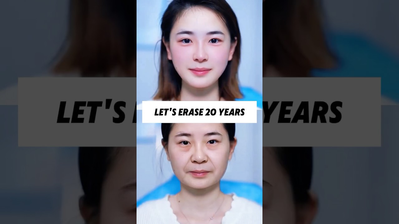 "A Facelift Without Surgery – Minimal Trauma, Big Transformation!"