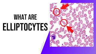 Elliptocytes Explained 🔬 | What They Are & Why They Matter in Blood Tests