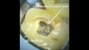 26 MB2 canal location