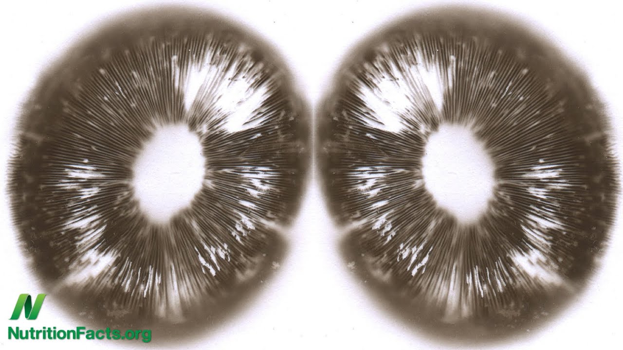 Breast Cancer vs. Mushrooms