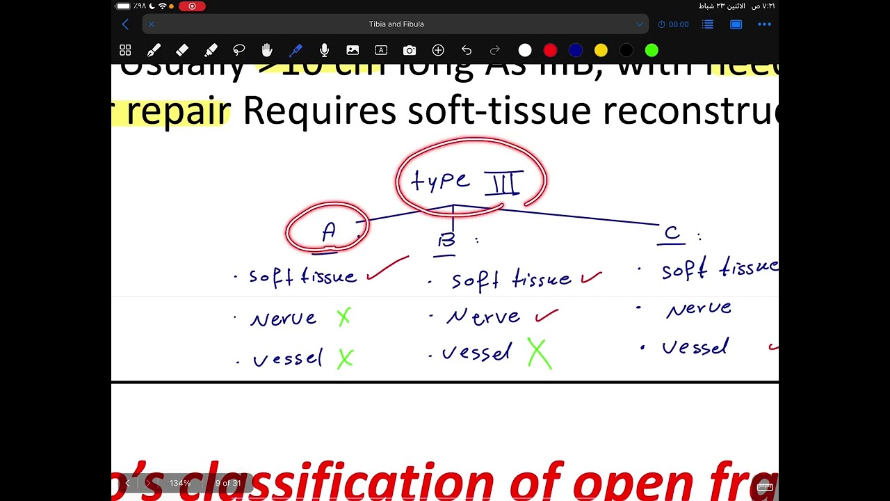 Orthopaedic / Fractures of Tibia and Fibula