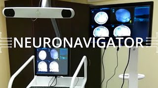 Promwad In Medtech Neuronavigator