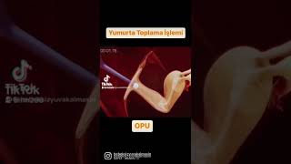 Yumurta Toplama İşlemi Opu