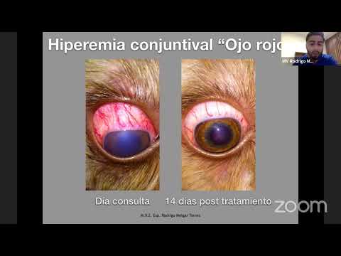 Uveítis, signología, diagnóstico y tratamiento hqdefault