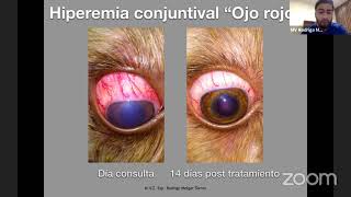 Uveítis, signología, diagnóstico y tratamiento