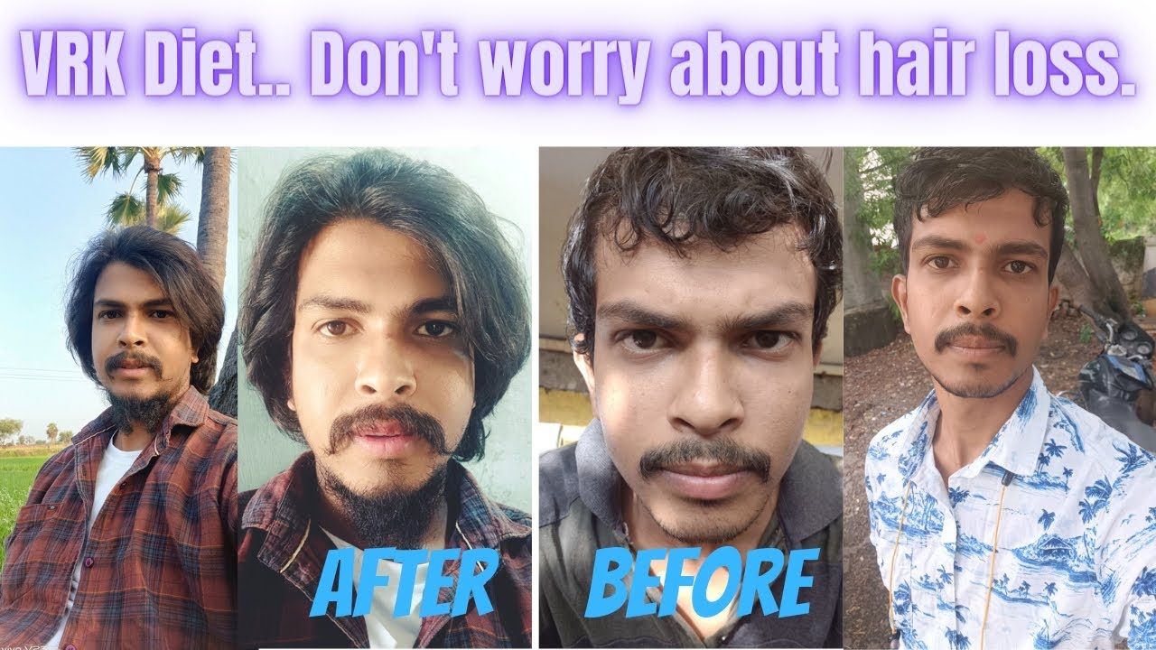 Vrk Diet Don t Worry About Hair Loss DS Naik Dietician vrk-diet-don-t-worry-about-hair-loss-ds-naik-dietician