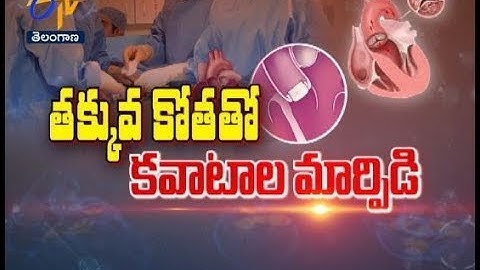 Complex Angioplasty: Treating Severe Heart Blockages Safely | Dr A Sharath Reddy