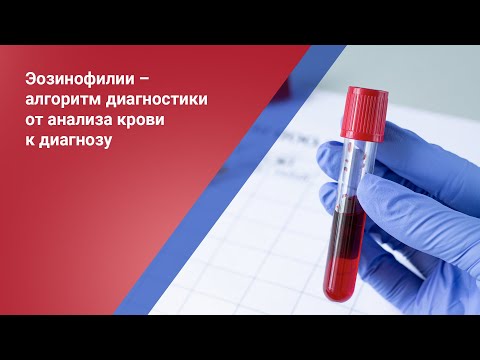 Видео: Какво е синдром на еозинофилия-миалгия (ems)?