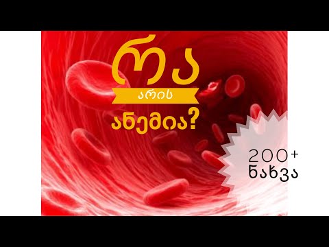 რა არის ანემია? Anemia|disorder|food habit| GKF|Health|Georgia