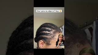 😱 HOW I GREE MY EDGES IN 7 DAYS! REAL RESULTS #shorts #hairgrowth #hairloss #alopecia #edges