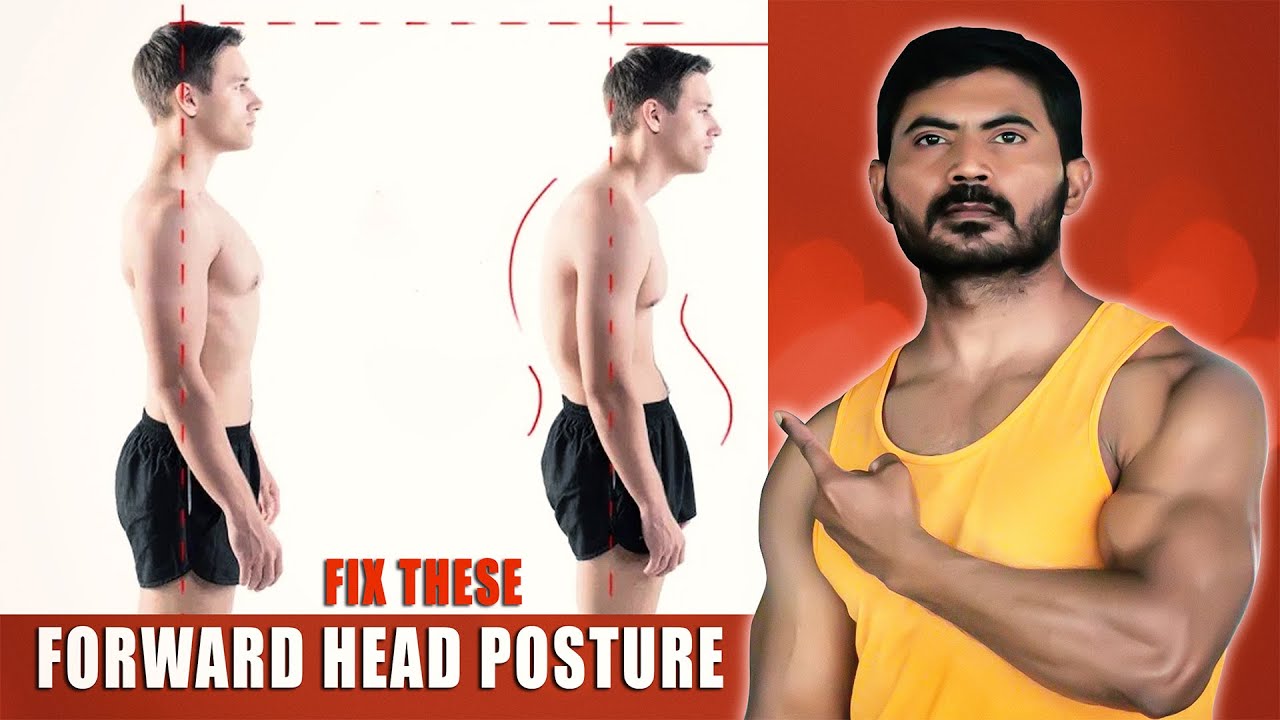 How To Fix Forward Head Posture In Telugu || Posture Correction Exercises - Venkat Fitness