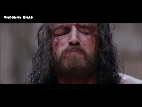 ترنيمه واحد جنبه اصبح ضده