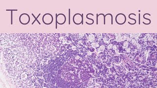 Toxoplasmosis - Pathology Mini Tutorials