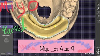 : Miyo    .  .  . Exocad.