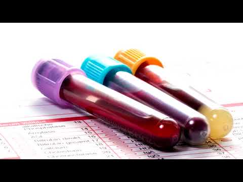 Video: Primäre Thrombozythämie: Ursachen, Symptome Und Diagnose
