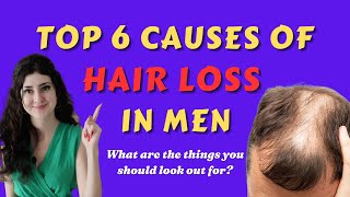Top 6 Causes of Hair Loss in Men