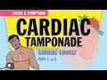 Cardiac Tamponade: Pathophysiology & Symptoms for Nursing Students & NCLEX (1 of 5)