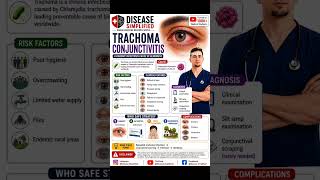 #conjunctivitis #ophthalmology #eyedisease #medicine #medicaleducation #neetpg #inicet #usmle #