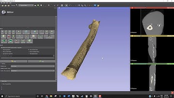 Empezando a usar Slicer 3D para segmentación Médica