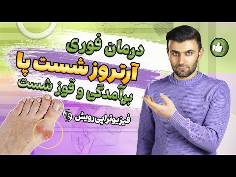 تصویری: 13 روش برای درمان درد انگشت پا