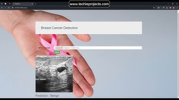 Breast Cancer Classification using Machine Learning | Machine Learning Projects