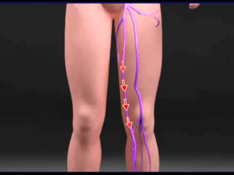 Leg Vein Blood Flow Example - YouTube