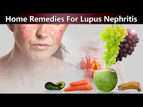 5 Best Home Remedies To Manage Lupus Nephritis