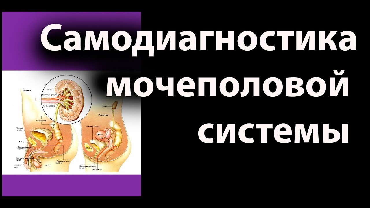 Самодиагностика мочеполовой системы. (№5 из цикла "Самодиагностика ...