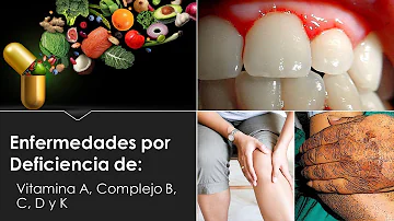 ¿Cómo evitar la deficiencia de vitamina A?