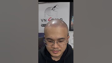 Xăm tóc đã thay đổi anh ấy như thế nào? #reviewxămtóc #barbershop #lamdep #scalp