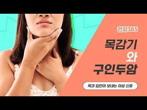 목과 입안이 보내는 이상 신호, 목감기와 구인두암 [TBC클리닉건강365] [TBC-띠비띠]