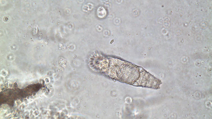 monogenean gyrodactylid sw monkeyfaceeel 40x SS