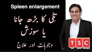 Spleen Enlargement Causes Symptoms and Treatment| Tili ka barh jana By Adeel mansoor Thumb