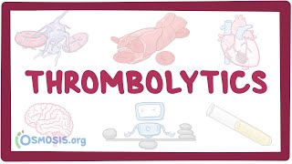 Thrombolytics ~pharmacology~