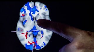 Can Gastric Bypass Surgery Change Your Brain? | Earth Lab Can Gastric Bypass Surgery Change Your Brain? | Earth Lab