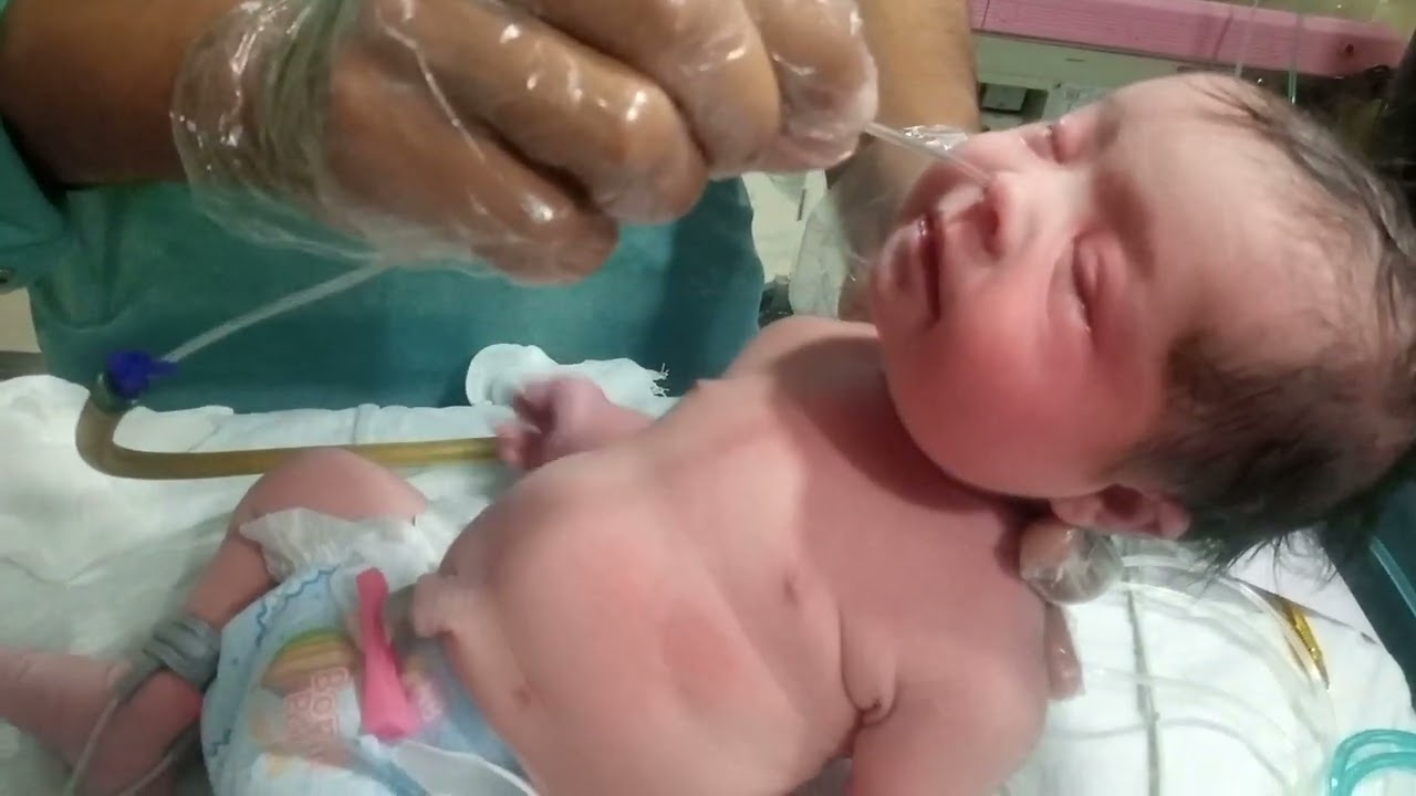 Nasal Suction From Newborn Baby| Suction Step by Step Technique | Nasal Aspirator| Newborn Baby|