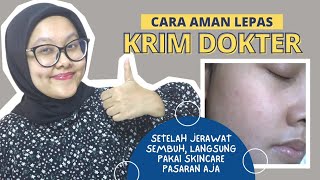 Cara Lepas Dari Krim Dokter Tanpa Breakout dan Beralih ke Skincare Pasaran