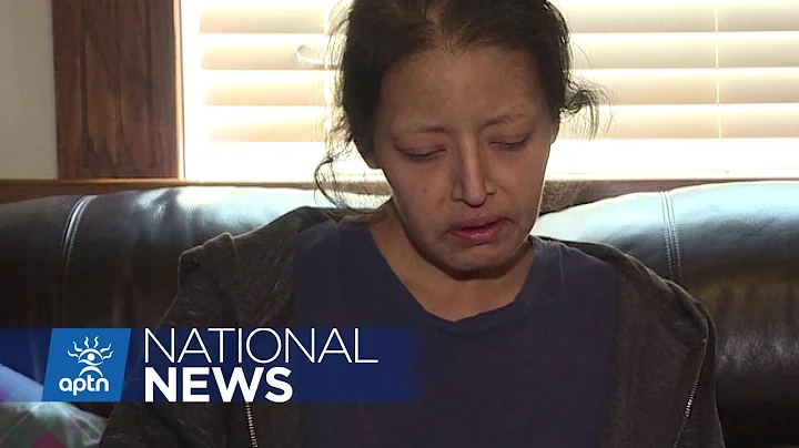 Barbara Kentner - Thunder Bay Woman Hit by Trailer...