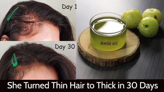 Amla oil for hair: 8 things to know, including whether it stops greys